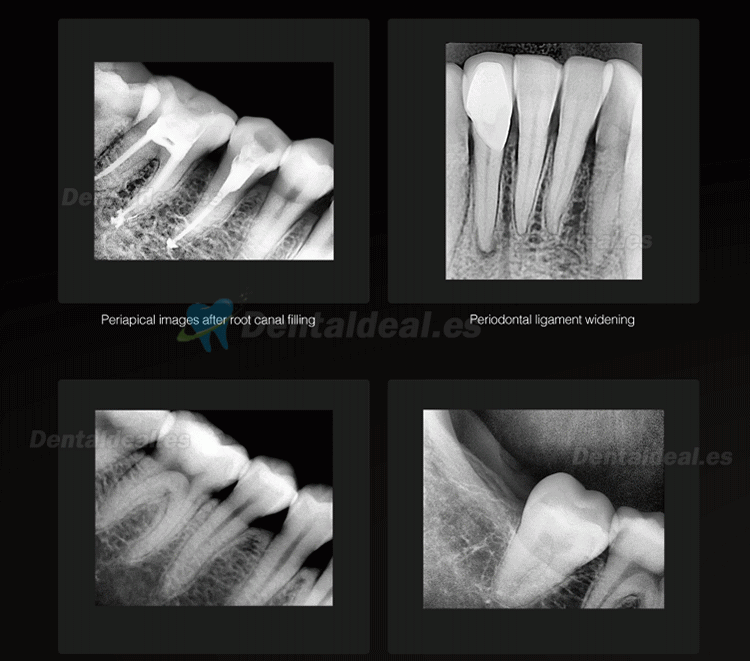 Runyes DR730 Sensor de rayos X digital dental Sistema de imagen de sensor intraoral